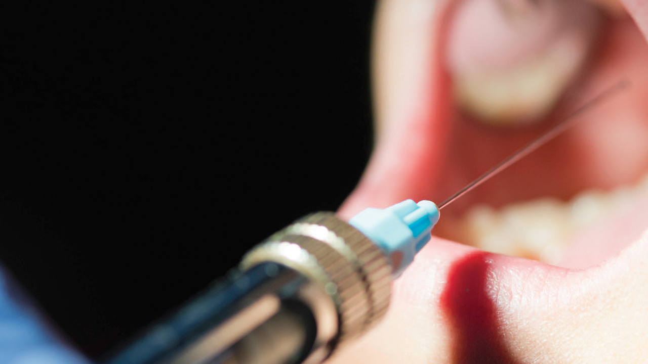 البنج الحلقة الأخطر في تخفيف ألم الأسنان