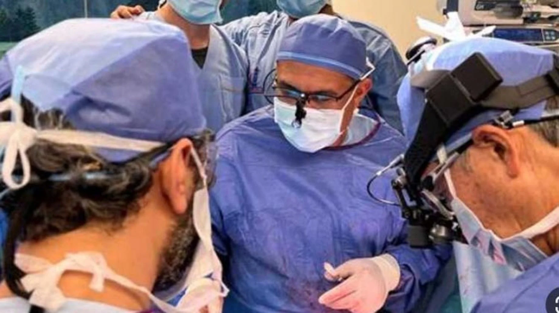 فريق جراحة زراعة الرئة في جامعة عين شمس