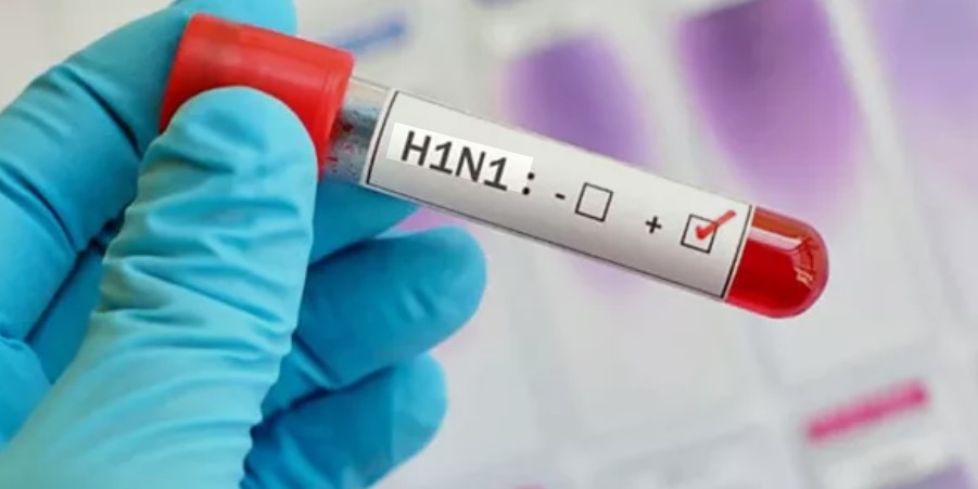 فيروس الإنفلونزا